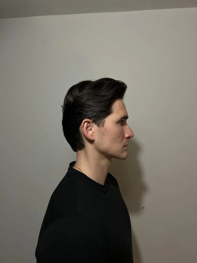 PHA Lifestyle Manchester Model Andy 1